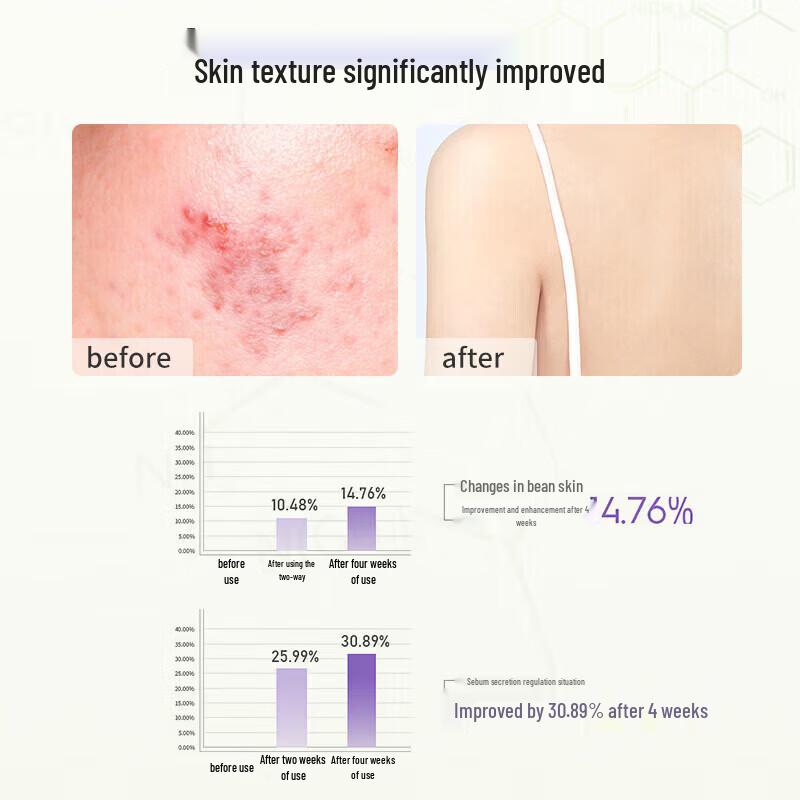 Seagilon Amino Acid Oil Control & Anti-Acne Body Wash
