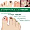 10ML Toenail Nail Fungus Treatment Repair Fingernail Device Foot Toenail Fungus Essential Care F0N3