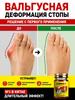 Cream Valgomed from Valgus