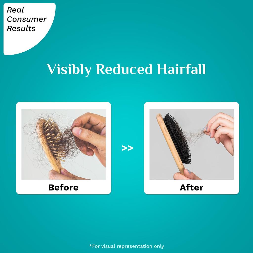 Pilgrim RootActive Anti-Hairfall Serum 30ml Pack Strengthens Hair Roots Reduces Hair Loss Boosts Density