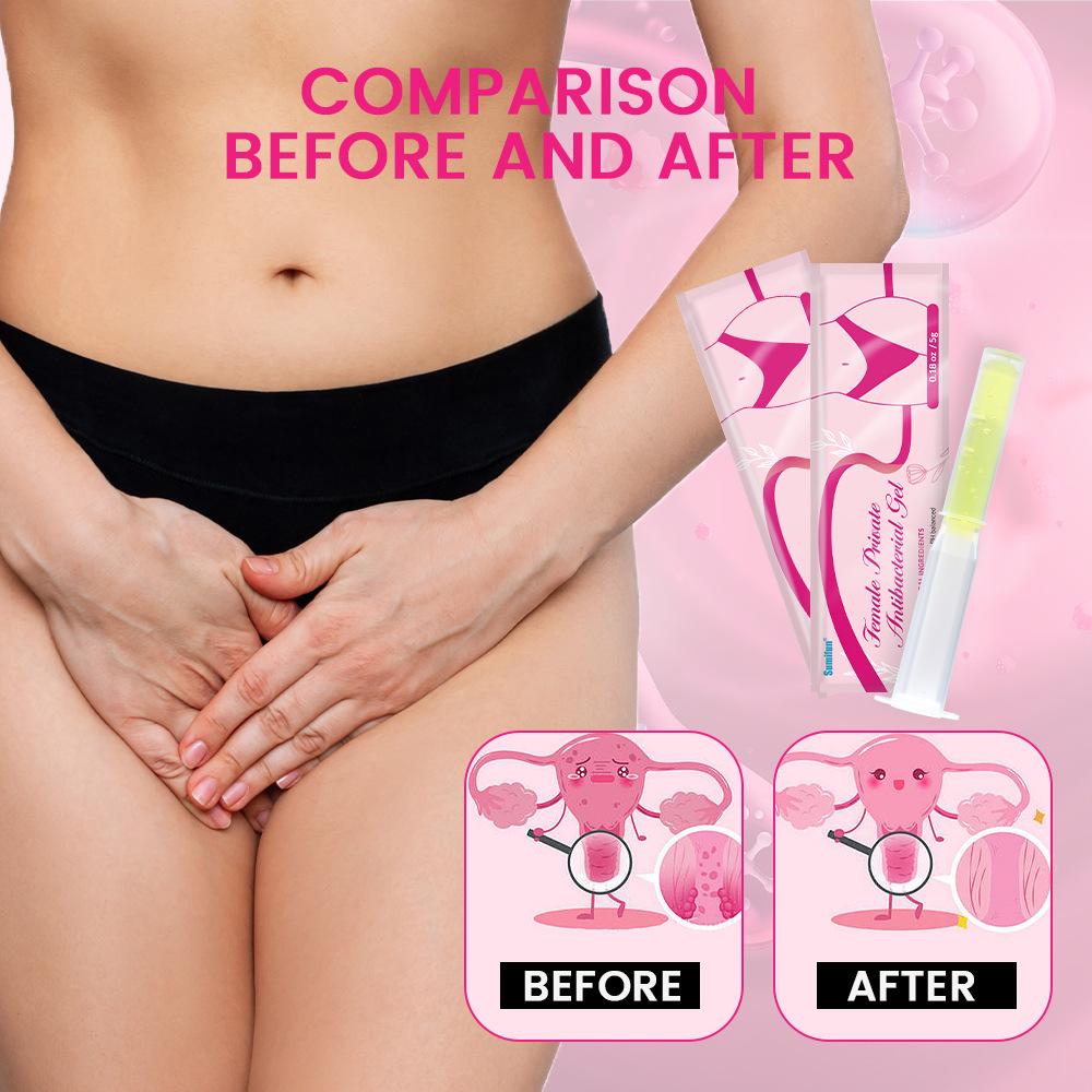 Female Vaginal Odor Care Cream, Itchy Cream, Dry Itching On The Inner Thighs, Genital Odor, Genital Itching, Redness