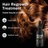 5% Minoxidil Haarwachstums-Serum mit Biotin, 60ml Haarwiederherstellungs-Behandlung gegen Haarausfall und Ausdünnung