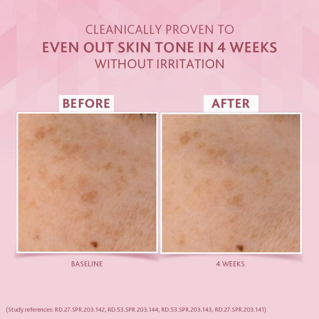 Cetaphil Brightening Day Protection Cream SPF 15 50 g With Niacinamide And Sea Daffodil For Dark Spots And Even Skin Tone