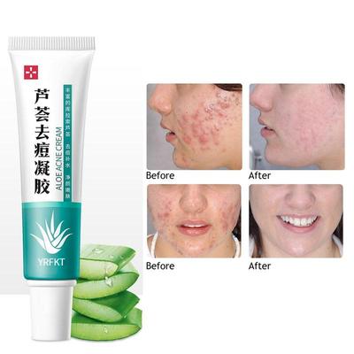 Krém proti akné s výtažkem z Aloe Vera Krém na spaní stahující póry