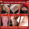 Herbal Varicose Veins Ointment - Relieves Tension Natural & Skin-Friendly