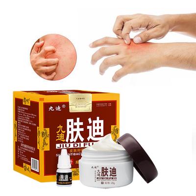 Herbal Cream Mosquito Bites and Itchy Skin Anti-itch Topical Cream