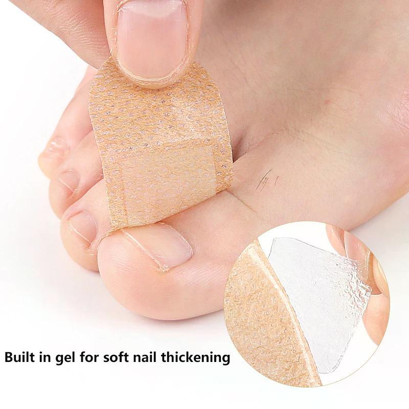 Toenail Patches Multi-Purpose Patches For Toenail Fingernail Non-Irritating And Breathable Waterproof Nails Foot Care Tool