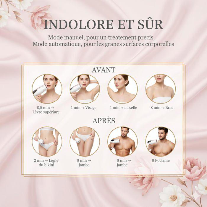 IPL pulsed light epilator - ZVVN - 999999 flashes - Ice cooling - 9 energy levels