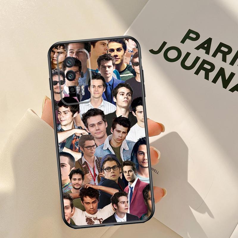 

Teen Wolf Dylan Obrien Case For Xiaomi 14 15 Ultra 13T 14T 15T Pro 17 Pro Max POCO X7 Pro X3 X5 X6 F5 F6 F7 F8 Coque POCO F8 Pro
