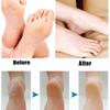 USB Electric Foot File Pedicure Grinding Foot Pedicure Dry Dead Skin Remover Exfoliating File Tool