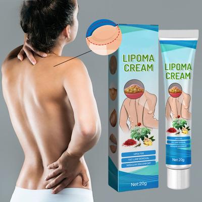 20g Fatty Lump Cream Painless Unblocking Continuous Penetration Resolve Subcutaneous Lumps Lump-Free Lipoma Removal Cream for Body