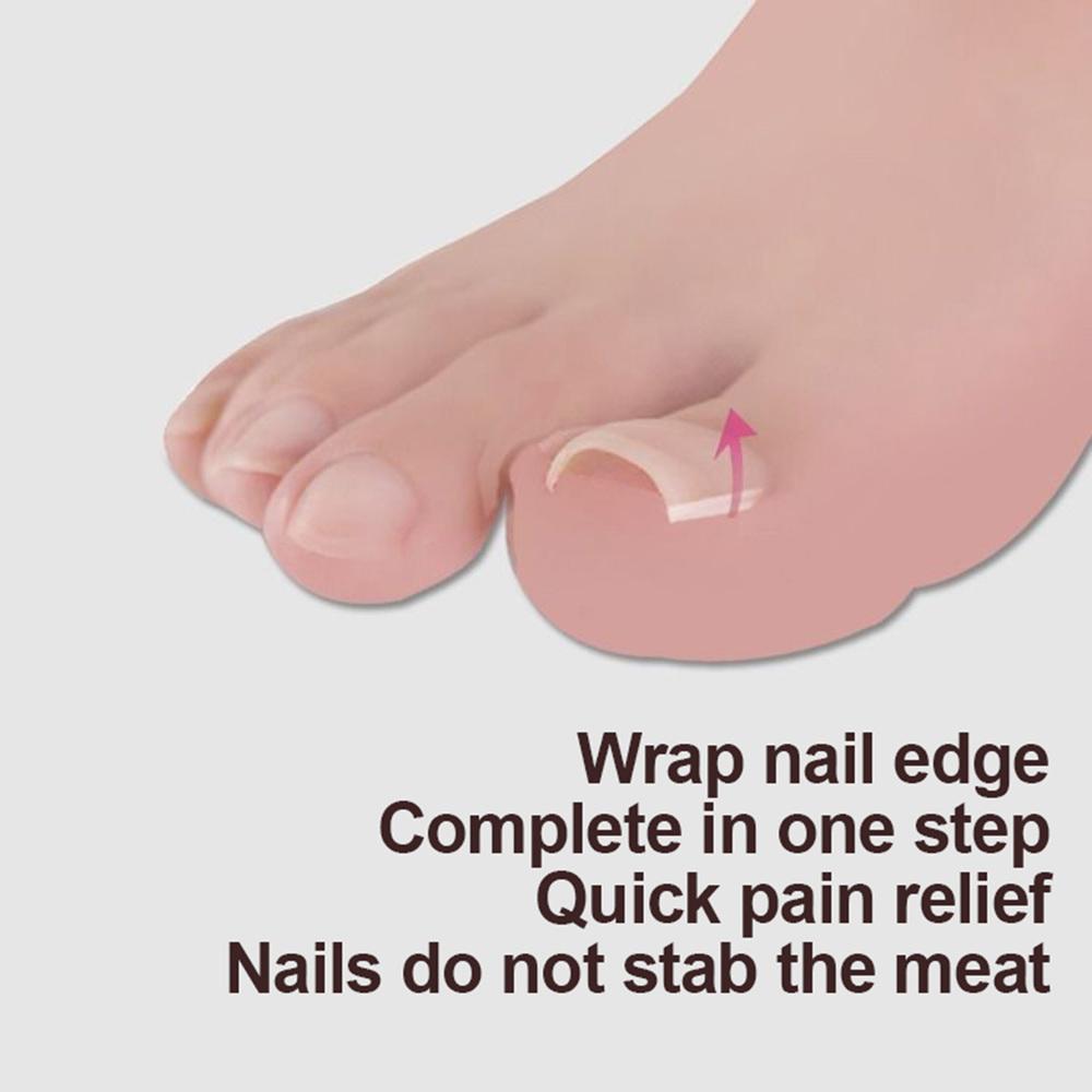 Toenail Correction Tool Toe Nail Treatment Elastic Patch Sticker Straightening Clip Brace Pedicure Tool