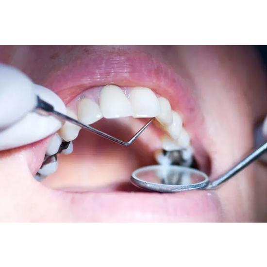 Sondă GDC cu un singur capăt -1 (Exs6l)