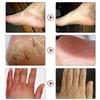 La più recente crema idratante riparatrice per la pelle delle mani e dei piedi anti-screpolature per piedi screpolati, secchi e screpolati, crema per i piedi riparatrice del tallone