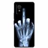 Für TCL 501 Hülle Luxus Mode Weiches TPU Schutz Silikon Handyhülle für TCL 501 T433D Rückseitenabdeckungen TCL501 etui Fundas 6.0"