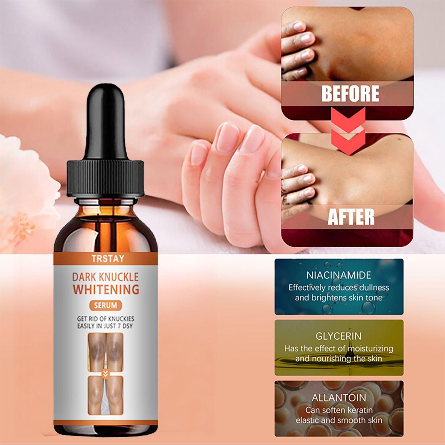 

Новая отбеливающая сыворотка из белого риса, увлажняющий крем для лица, против морщин, против старения, для лица, для лечения тонких линий, акне, уход за кожей