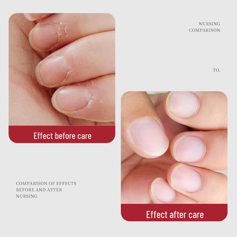 Large Bottle Nail Care Oil: Nourishing Cuticle Oil with Plant Fragrance for Moisturizing, Anti-Splitting, and Dead Skin Removal.