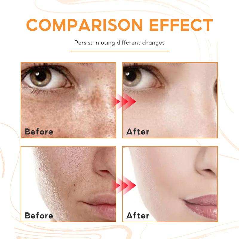 Pure Vegan Face Cream 30ml Mooth Delicate Radiant and Translucent Rapid Absorption of Skin Retinol Anti Aging Serum