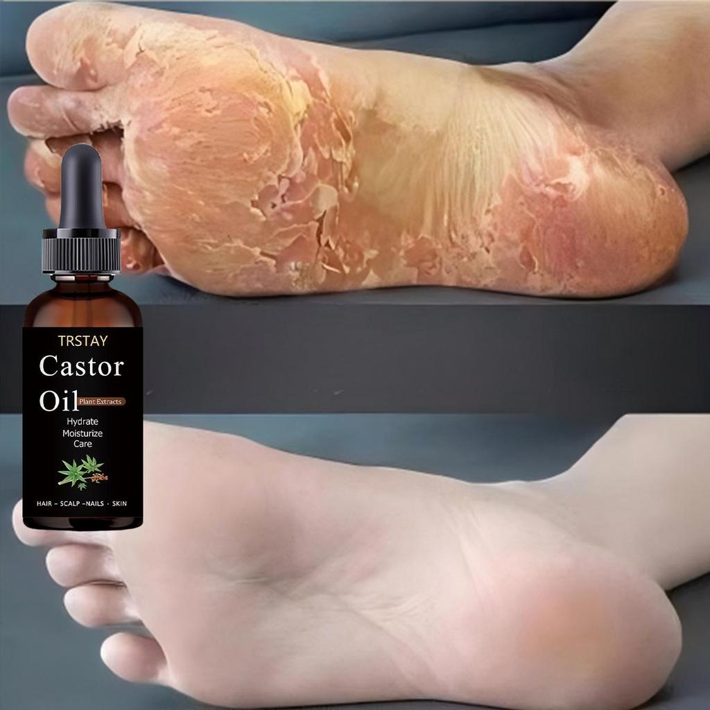 Foot Cracking, with Slight Relief and Flexibility, Refreshing and Comfortable