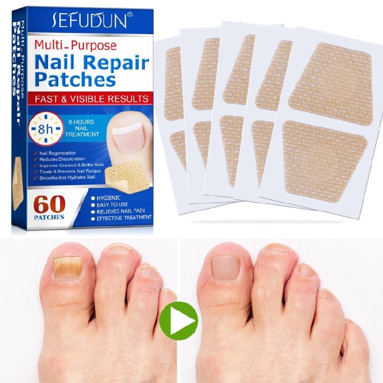 Ingrown Toenail Sticker Corrector Patches Big Toe Nail Corrector Renewal Plaster