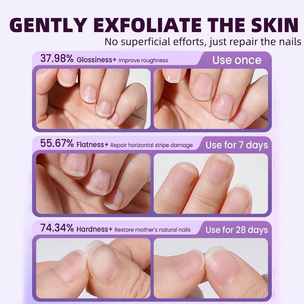 Nail Care Pen Cuticle Remover Hangnail Repair Tool Damaged Nail Treatment File Nourishing Oil for Nail Edge Moisturizing