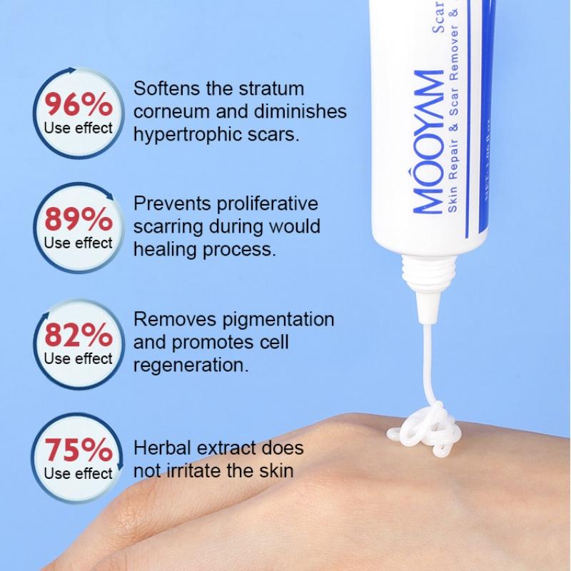 Fjerning av arr Hjelper mot gamle og nye arr for kirurgisk for ansikt og kropp