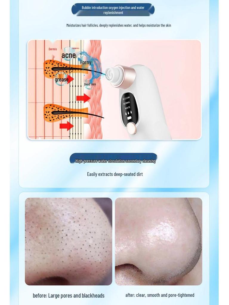 Portable Bubble Blackhead Remover & Facial Pore Cleaner with Oxygen Injection