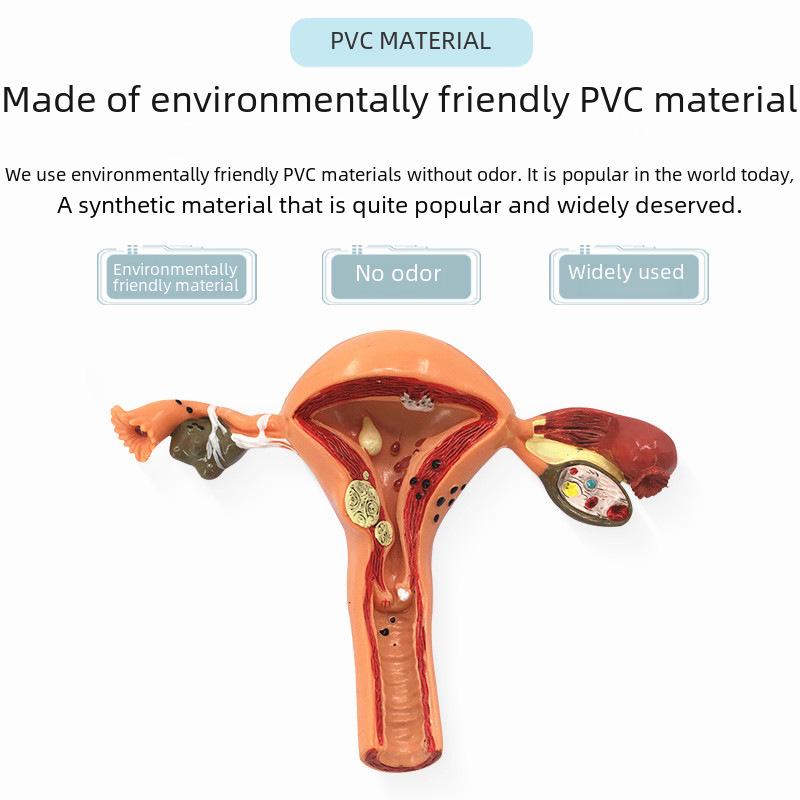 Large Female Reproductive Anatomy Model for Teaching and Family Planning