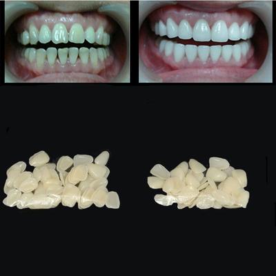 Salud Carillas Ultrafinas Blanqueamiento Dientes de Porcelana Anteriores Superiores Películas Dentales Dientes de Resina
