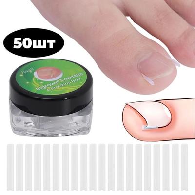 50 ADET Batık Tırnak Dolgu Pedi Kılıf Tırnak Pedi C Şeklinde Tırnak Pedi Batık Tırnak Düzeltici Pedikür Aleti