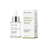 West Month Centella Asiatica Repair Essence Moisturizes And Hydrates The Skin, Repairing And Rejuvenating The Skin Essence