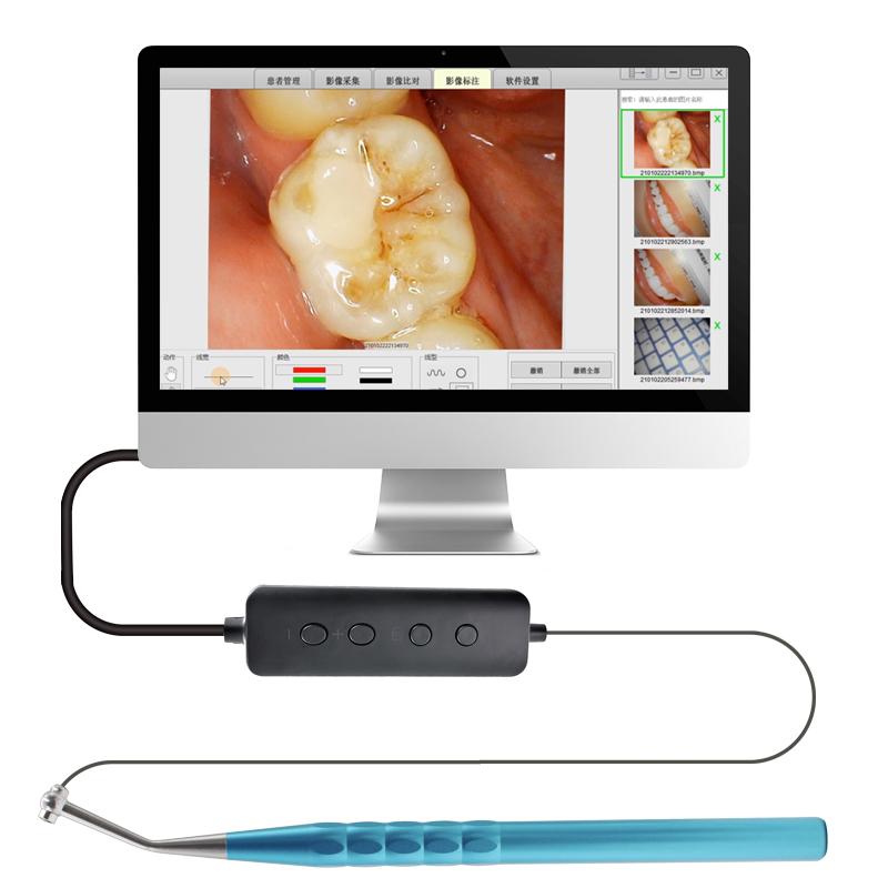 Dental Orthodontics Leagues LED Visual Dental Digital Micro Intra Oral Camera Wifi Foot Control HD Visual Camera for Endo Motor