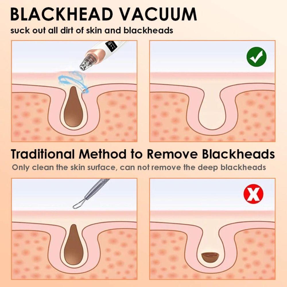 3 Saugmodi Elektrischer Mitesserentferner Tiefenreinigung Gesichtswaschgerät Gesichtsporen