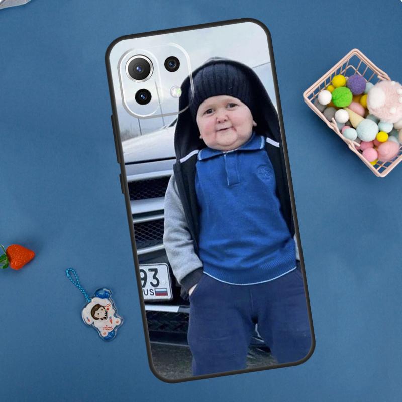 Funny Hasbulla Case For Xiaomi 14 13 15 Ultra 11T 12T 13T 14T Pro POCO X7 Pro X3 X5 F5 F6 M6 X6 Pro Cover