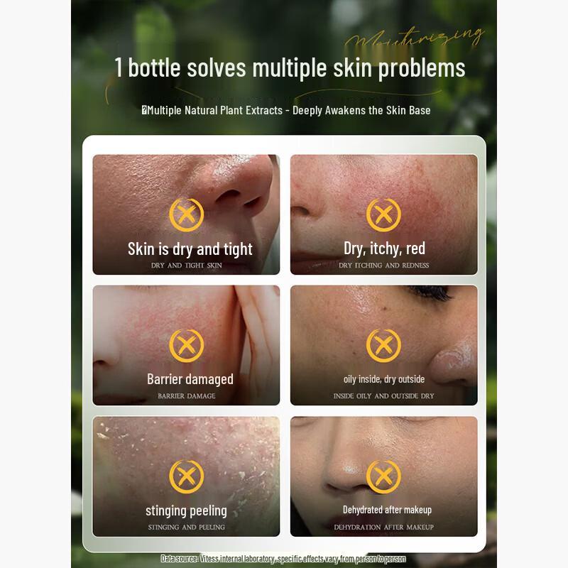 VTS Centella Asiatica Hydrating Lotion