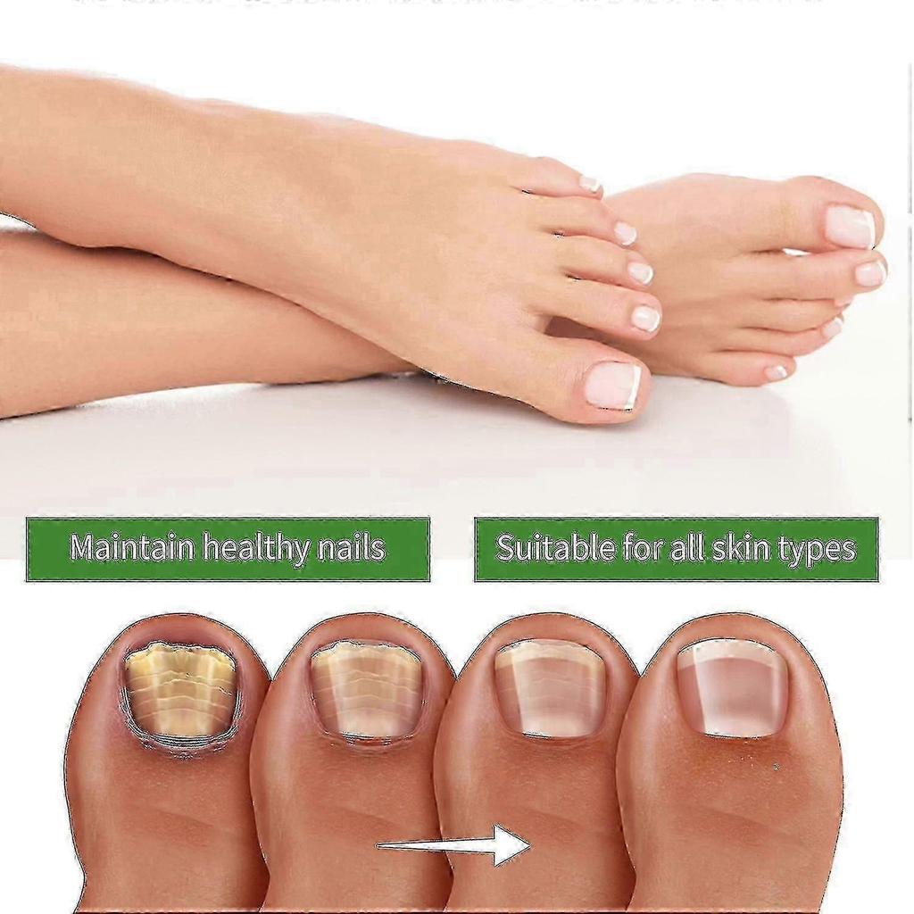 Medi-care Toenail Stick, Nails Soft Nails Nails Massage Nails Care B
