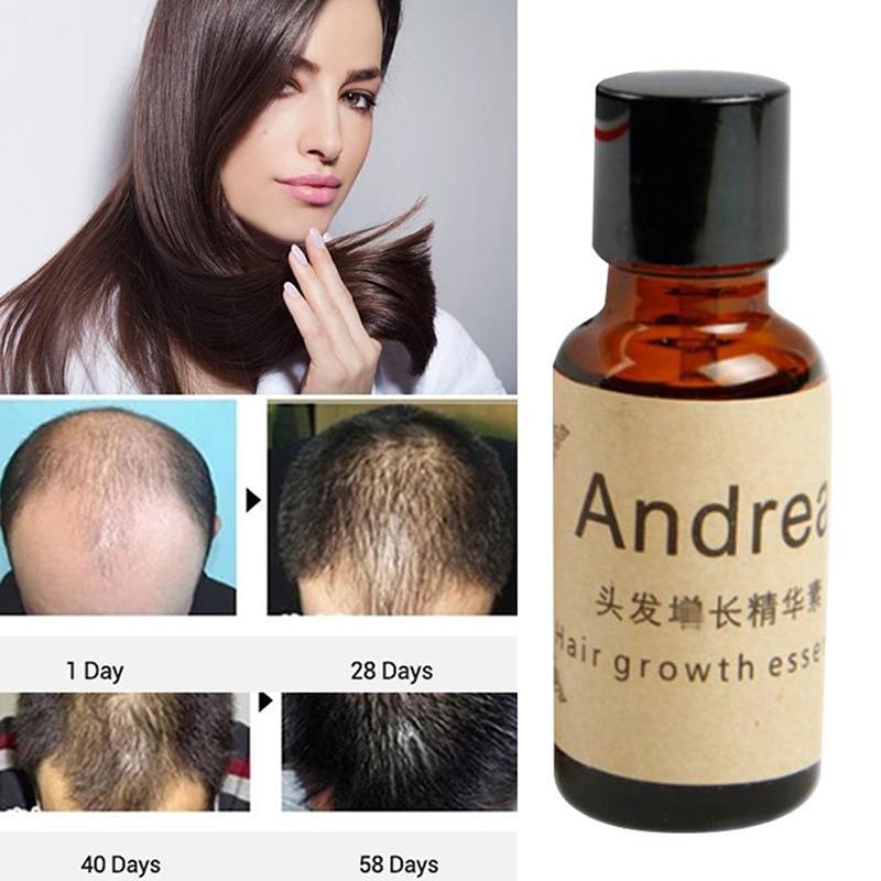 Fast Hair Growth Essentielle Herbal Keratin Andrea Alopecia Loss Liquid Ginger