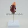 1:1 Modell einer menschlichen Niere - Abnehmbares Harnsystem Anatomie Lehrmittel