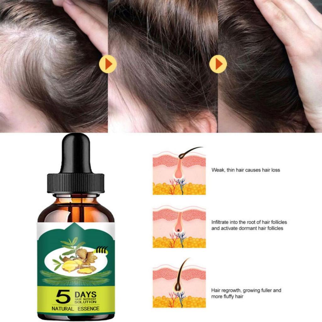 Liquide anti-chute de cheveux pour hommes et femmes Huile essentielle raffermissante pour les cheveux Essence nourrissante réparatrice pour les cheveux Liquide de croissance des cheveux