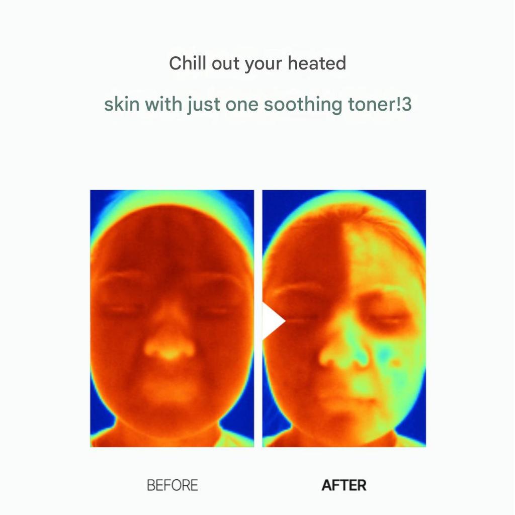 Anua Heartleaf 77% Beruhigendes Gesichtswasser