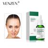VENZEN Salicylic Acid Pore Refining Essence Reintegrante Idratante Cura Delicata Acqua per Pori Restringenti Lozione di Bellezza Luminosa