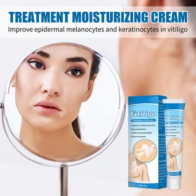 White Spot Piebald Cream Vitiligo Ointment Herbal Sweat Spot Cream Body Skin Care