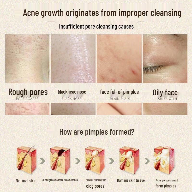 LAOZHONGYI Facial Cleansers