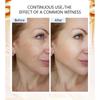 Niacinamide Anti-Wrinkle Facial Essence Fades Flare To Improve Dull and Brighten Skin Tone