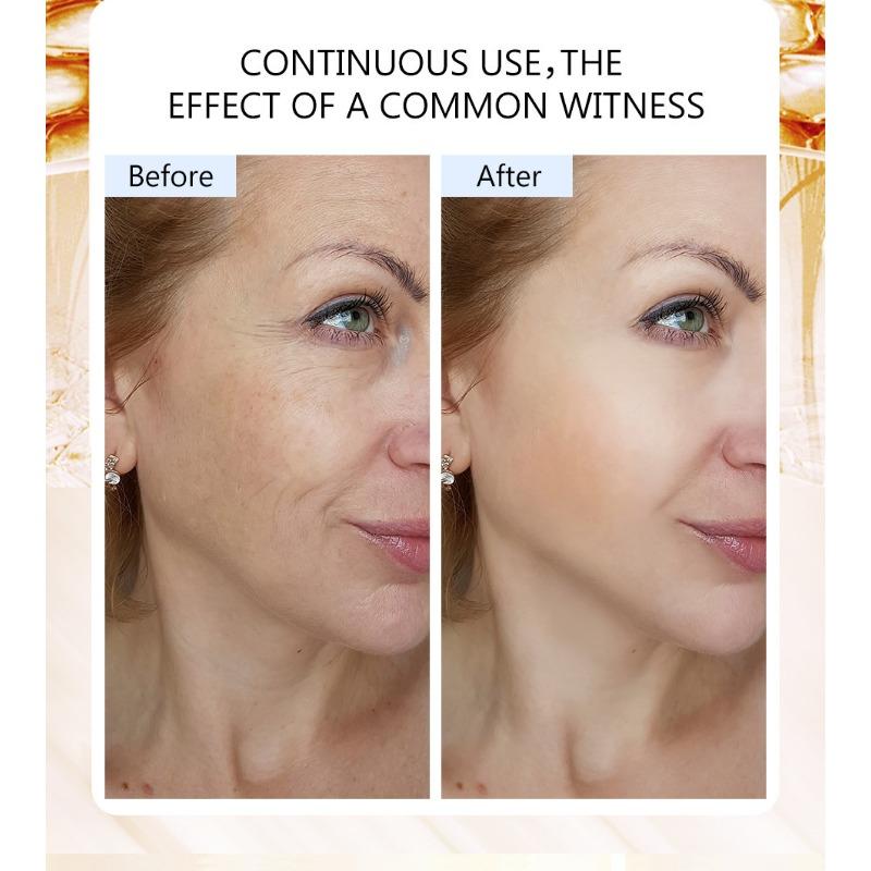 Niacinamide Anti-Wrinkle Facial Essence Fades Flare To Improve Dull and Brighten Skin Tone