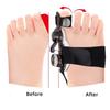 Children Bunion Corrector Adjustable Rotatable Toe Separator Straightener Phased Adjustment Foot Valgus Braces Unisex