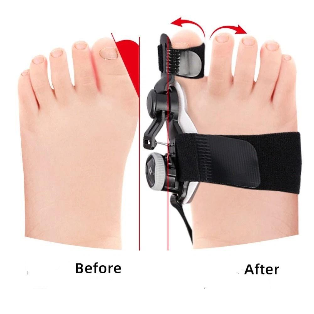 Children Bunion Corrector Adjustable Rotatable Toe Separator Straightener Phased Adjustment Foot Valgus Braces Unisex