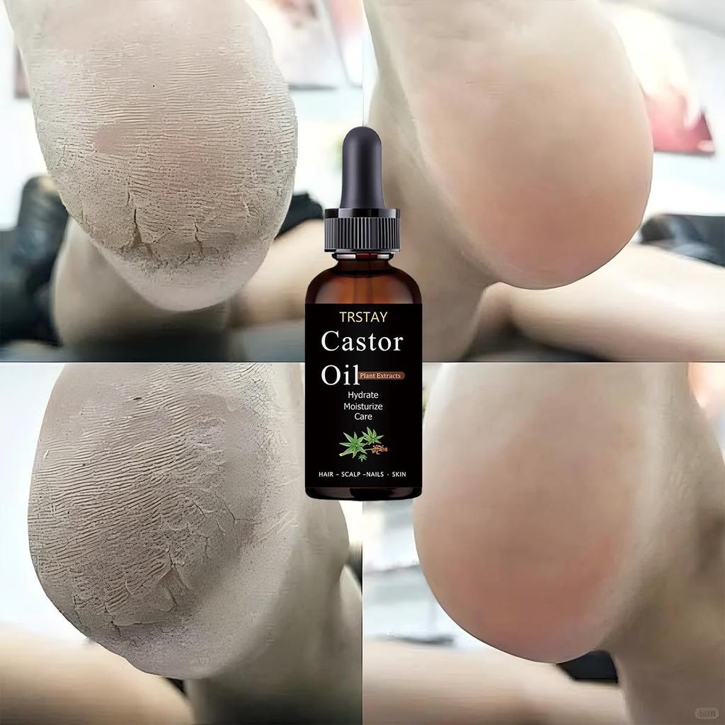 Foot Cracking, with Slight Relief and Flexibility, Refreshing and Comfortable