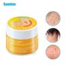 Sumifun 10g Tinea Relief Ointment for Hand, Foot, Inner Thigh Itch (K20004)