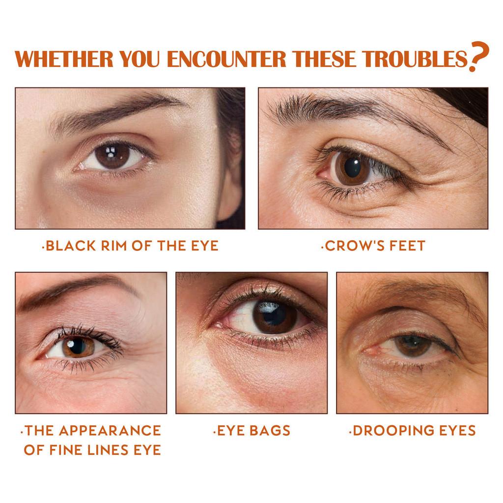 Ouhoe Anti-wrinkle Eye Serum 30ml For Firm Skin Reduces Fine Lines And Dark Circles